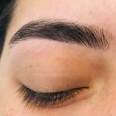 Brow Treatment (6)